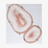 laceration02