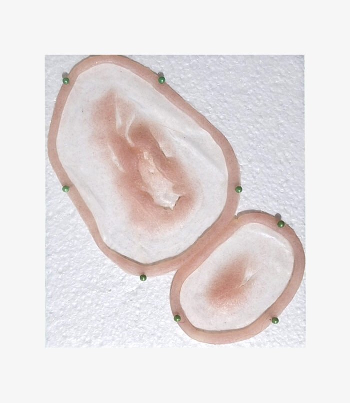 laceration02